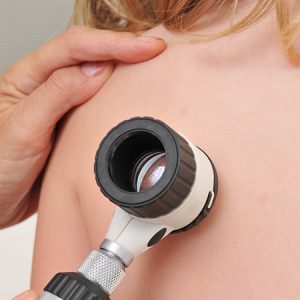 Dermatologist examines child patient birthmark with dermatoscope